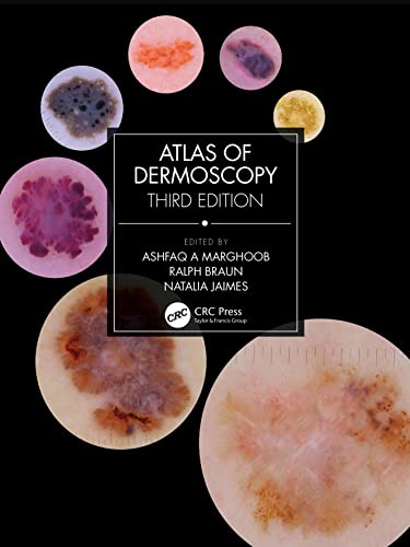 Atlas of Dermoscopy: Third Edition von CRC Press